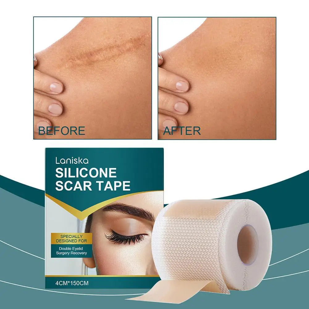 Premium Silicone Scar Sheet